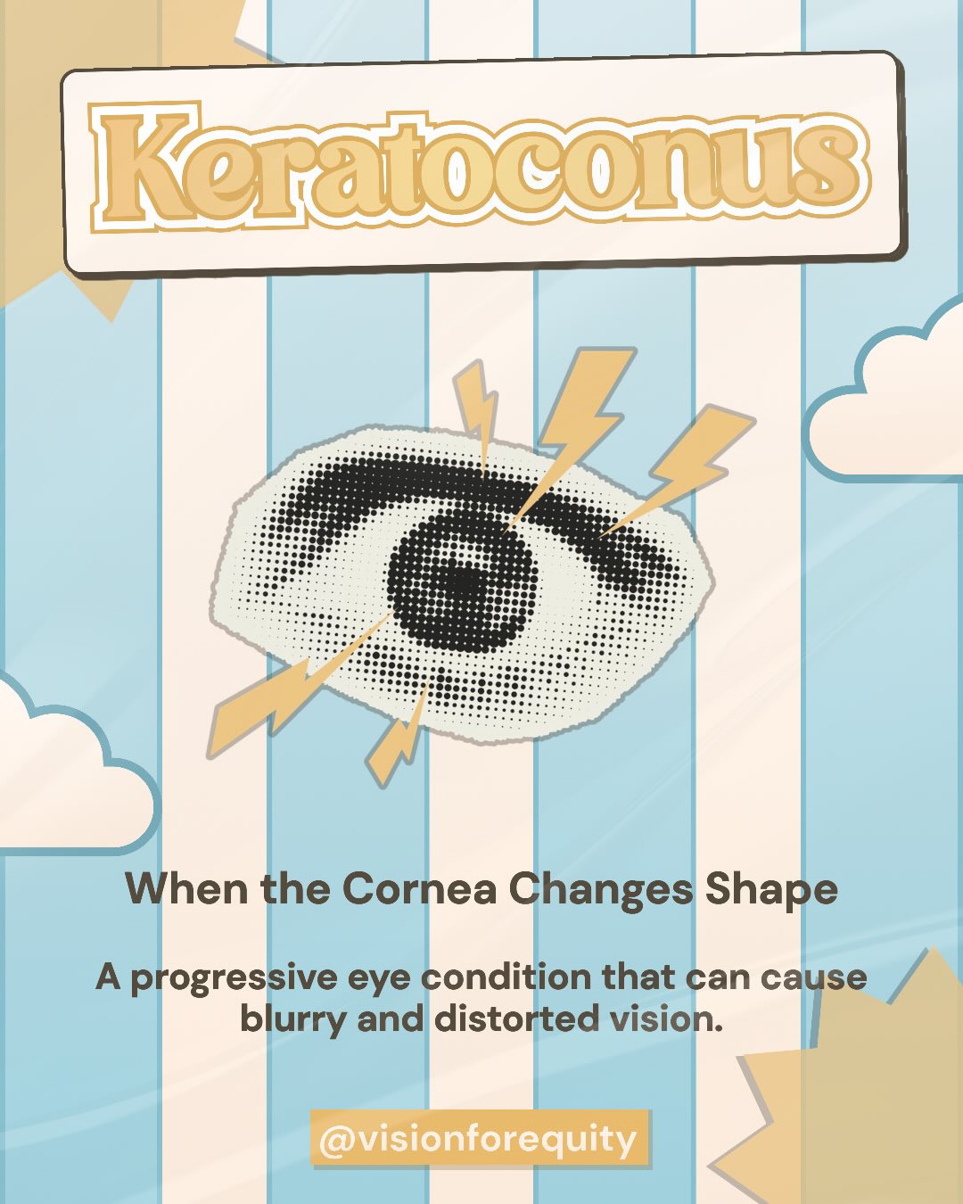 Keratoconus educational post cover