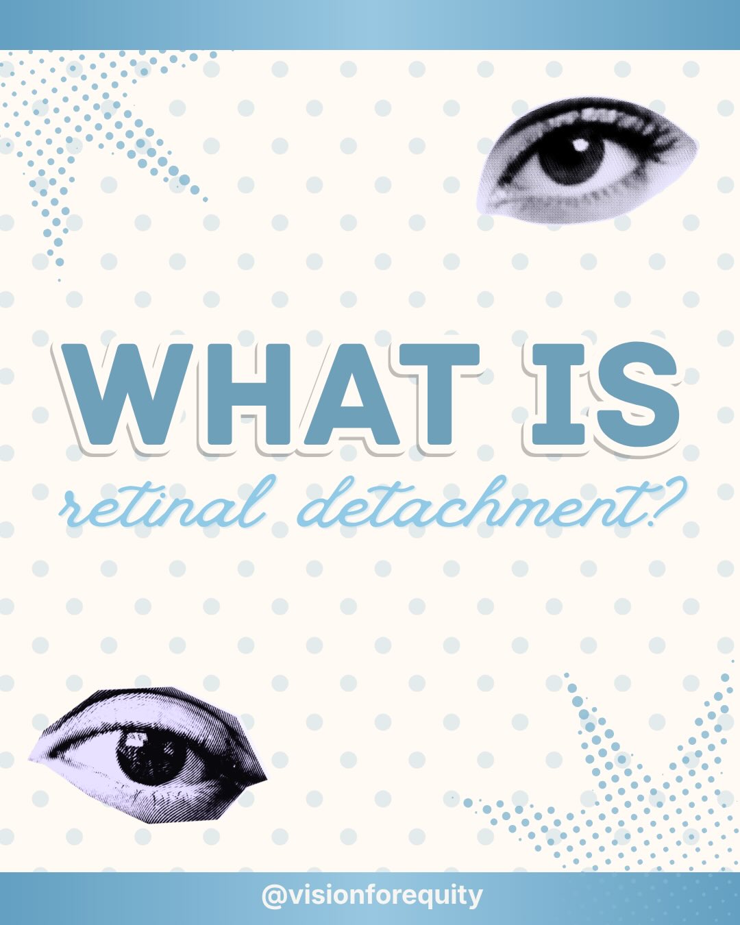 Retinal Detachment educational post cover